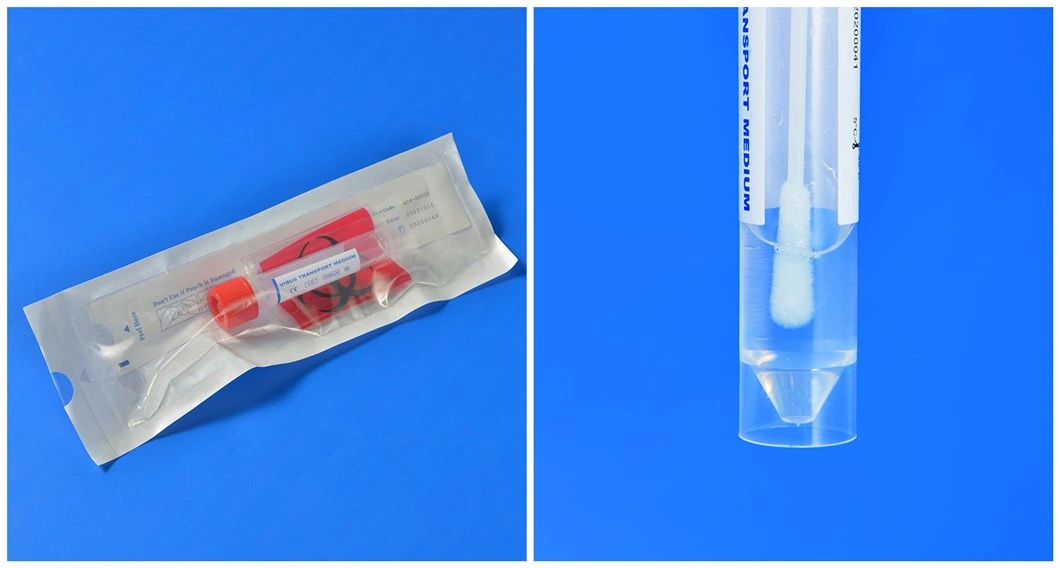 Point-of-Care Test Disposable Sterile Virus Sampling Collection Kit Vtm Kit with Nasal Throat Swabs